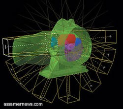 العلاج الإشعاعي" في تخصصي الدمام يحصل على شهادة TLD من وكالة الطاقة الذرية