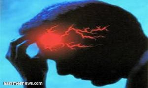 طبيب إماراتي يتوصل لتقنية تعالج السكتة الدماغية والإدمان 