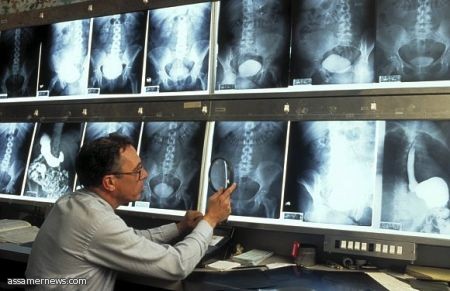 أشعة إكس.. الأطباء يتجاهلون المخاطر والتأثيرات البعيدة للإشعاع!